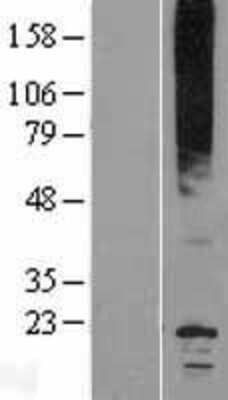 Western Blot: Aquaporin-0 Overexpression Lysate (Adult Normal) [NBP2-10364] Left-Empty vector transfected control cell lysate (HEK293 cell lysate); Right -Over-expression Lysate for Aquaporin-0.