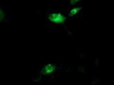 Immunocytochemistry/Immunofluorescence: Aquaporin 1/AQP1 Antibody (OTI2D10) - Azide and BSA Free [NBP2-70199] - Staining of COS7 cells transiently transfected by pCMV6-ENTRY Aquaporin-1.