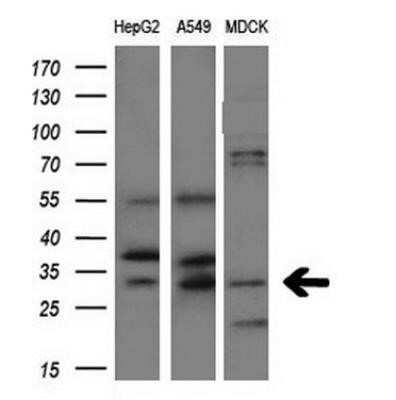 Western Blot: Aquaporin 1/AQP1 Antibody (OTI2D10) - Azide and BSA Free [NBP2-70199] - Analysis of extracts (10ug) from 3 different cell lines by using anti-AQP1 monoclonal antibody at 1:200 dilution.