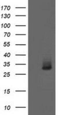 Western Blot: Aquaporin 1/AQP1 Antibody (OTI2D10) - Azide and BSA Free [NBP2-70199] - HEK293T cells were transfected with the pCMV6-ENTRY control (Left lane) or pCMV6-ENTRY Aquaporin-1 (Right lane) cDNA for 48 hrs and lysed. Equivalent amounts of cell lysates (5 ug per lane) were separated by SDS-PAGE and immunoblotted with anti-Aquaporin