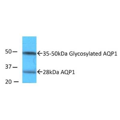 Western Blot: Aquaporin 1/AQP1 Antibody [NBP1-97925] - Western blot analysis of Rat kidney inner medullary homogenates showing detection of Aquaporin 1/AQP1 protein using Rabbit Anti-Aquaporin 1/AQP1 Polyclonal Antibody (NBP1-97925). Primary Antibody: Rabbit Anti-Aquaporin 1/AQP1 Polyclonal Antibody (NBP1-97925) at 1:2000. Showing glycosylated and non-glycosylated bands.