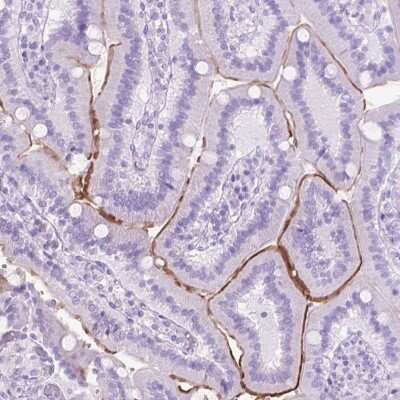 Immunohistochemistry-Paraffin: Aquaporin-10 Antibody [NBP2-49466] - Staining of human duodenum shows high expression.