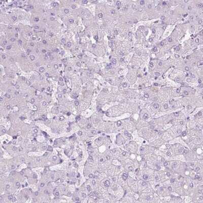 Immunohistochemistry-Paraffin: Aquaporin-10 Antibody [NBP2-49466] - Staining of human liver shows low expression as expected.