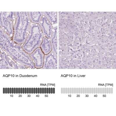 Immunohistochemistry-Paraffin: Aquaporin-10 Antibody [NBP2-49466] - Staining in human duodenum and liver tissues using anti-AQP10 antibody. Corresponding AQP10 RNA-seq data are presented for the same tissues.