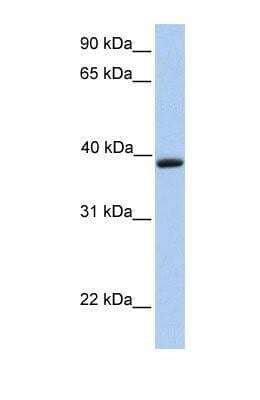 Western Blot: Aquaporin-10 Antibody [NBP1-69625] - Aquaporin-10 Antibody This Anti-AQP10 antibody was used in Western Blot of Jurkat tissue lysate at a concentration of 1ug/ml.