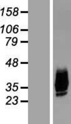 Western Blot: Aquaporin-10 Overexpression Lysate (Adult Normal) [NBL1-07636] Left-Empty vector transfected control cell lysate (HEK293 cell lysate); Right -Over-expression Lysate for Aquaporin-10.