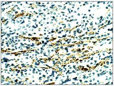 Immunohistochemistry-Paraffin: Aquaporin-11 Antibody [NBP3-12234] - Aquaporin 11 1:50 dilution in IHC blocking buffer. DAB (brown) staining and hematoxylin QS (blue) counterstain. 40X magnification. FFPE sections.