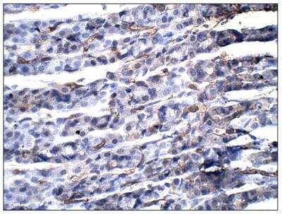 Immunohistochemistry-Paraffin: Aquaporin-11 Antibody [NBP3-12234] - Aquaporin 11. 1:50 dilution in IHC blocking buffer. DAB (brown) staining and hematoxylin QS (blue) counterstain. 40X magnification. FFPE section. 