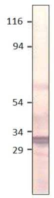 Western Blot: Aquaporin-11 Antibody [NBP3-12234] - WB. 1:500 antibody dilution in diluObuffer