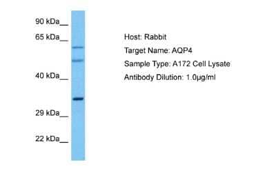 Western Blot: Aquaporin-4 Antibody [NBP2-87019] - Host: Rabbit. Target Name: AQP4. Sample Tissue: Human A172 Whole Cell lysates. Antibody Dilution: 1ug/ml