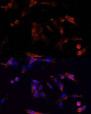 Immunocytochemistry/Immunofluorescence: Aquaporin-5 Antibody [NBP2-92926] - Analysis of NIH/3T3 cells using Aquaporin-5 at dilution of 1:100. Blue: DAPI for nuclear staining.