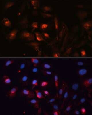 Immunocytochemistry/Immunofluorescence: Aquaporin-5 Antibody [NBP2-92926] - Analysis of U2OS cells using Aquaporin-5 at dilution of 1:100. Blue: DAPI for nuclear staining.