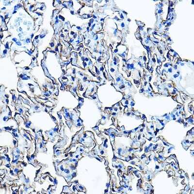 Immunohistochemistry-Paraffin: Aquaporin-5 Antibody [NBP3-02963] - Immunohistochemistry of paraffin-embedded rat lung using Aquaporin-5 Rabbit pAb (NBP3-02963) at dilution of 1:100 (40x lens). Perform high pressure antigen retrieval with 10 mM citrate buffer pH 6.0 before commencing with IHC staining protocol.