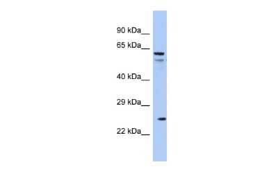 Western Blot: Aquaporin-5 Antibody [NBP2-84445] - Host: Rabbit. Target Name: AQP5. Sample Type: COLO205 Whole cell lysates. Antibody Dilution: 1.0ug/mlAQP5 is supported by BioGPS gene expression data to be expressed in COLO205