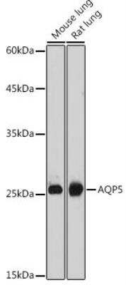 Western Blot: Aquaporin-5 Antibody [NBP2-92926] - Analysis of extracts of various cell lines, using AQP5 antibody at 1:1000 dilution.Secondary antibody: HRP Goat Anti-Rabbit IgG (H+L)  at 1:10000 dilution.Lysates/proteins: 25ug per lane. Blocking buffer: 3% nonfat dry milk in TBST.Detection: ECL Basic Kit. Exposure time: 90s.