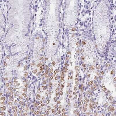 Immunohistochemistry-Paraffin: Aquaporin-6 Antibody [NBP1-90119] - Staining of human stomach shows moderate to strong cytoplasmic positivity in a subset of glandular cells.