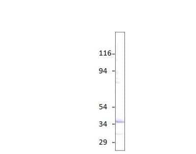 Western Blot: Aquaporin-6 Antibody [NBP3-12380] - 1:500 antibody dilution in Diluobuffer. Apparent MW is 35 KDa.