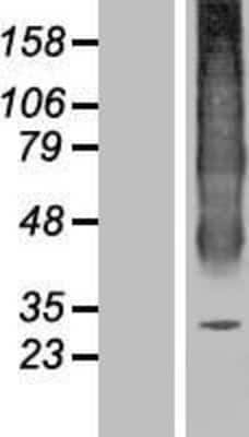 Western Blot: Aquaporin-6 Overexpression Lysate (Adult Normal) [NBP2-10980] Left-Empty vector transfected control cell lysate (HEK293 cell lysate); Right -Over-expression Lysate for Aquaporin-6.