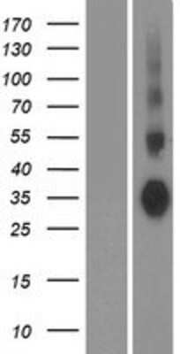 Western Blot: Aquaporin-7 Overexpression Lysate (Adult Normal) [NBP2-10958] Left-Empty vector transfected control cell lysate (HEK293 cell lysate); Right -Over-expression Lysate for Aquaporin-7.