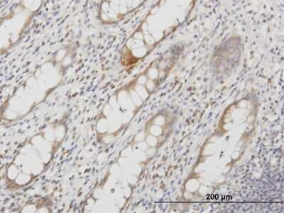 Immunohistochemistry-Paraffin: Aquaporin-8 Antibody (1F8) [H00000343-M03] - Analysis of monoclonal antibody to AQP8 on formalin-fixed paraffin-embedded human colon. Antibody concentration 3 ug/ml