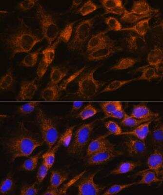 Immunocytochemistry/Immunofluorescence: Aquaporin-8 Antibody [NBP2-92557] - Analysis of C6 cells using AQP8 Rabbit pAb at dilution of 1:100. Blue: DAPI for nuclear staining.