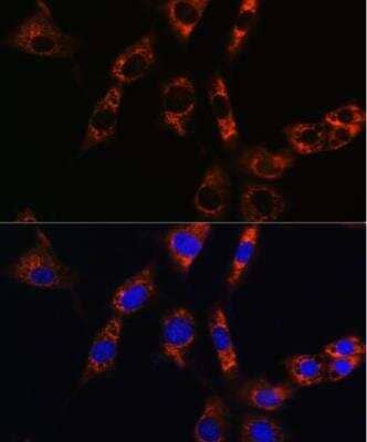 Immunocytochemistry/Immunofluorescence: Aquaporin-8 Antibody [NBP2-92557] - Analysis of NIH/3T3 cells using AQP8 Rabbit pAb at dilution of 1:100. Blue: DAPI for nuclear staining.