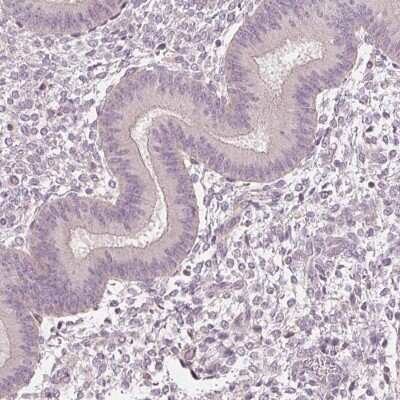 Immunohistochemistry-Paraffin: Aquaporin-8 Antibody [NBP1-91676] - Staining of human endometrium shows low expression as expected.