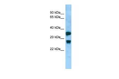 Western Blot: Aquaporin-8 Antibody [NBP3-10585] - Western blot analysis of Aquaporin-8 in Rat Small Intestine lysates. Antibody dilution at 1.0ug/ml