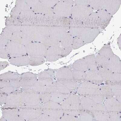 Immunohistochemistry-Paraffin: Aquaporin-9 Antibody [NBP2-62691] - Staining of human skeletal muscle shows low expression as expected.