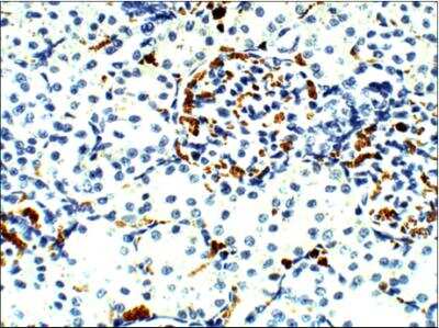 Immunohistochemistry-Paraffin: Aquaporin-9 Antibody [NBP3-12260] - Rat Kidney-Aquaporin 9. 1:100 dilution inIHC Blocking Buffer. DAB (brown) straining and Hematoxylin in QS (blue) counterstain. 40x magnification on Leica DM4000. FFPE section.