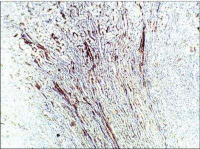 Immunohistochemistry-Paraffin: Aquaporin-9 Antibody [NBP3-12260] - Rat Kidney-Aquaporin 9. 1:100 dilution in IHC Blocking Buffer. DAB (brown) straining and Hematoxylin QS (blue) counterstain. 5x Magnification on Leica DM4000 FFPE Section.