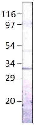 Western Blot Aquaporin-9 Antibody