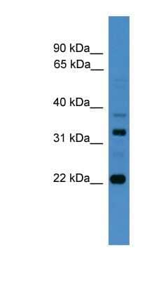 Western Blot: Archaemetzincin 2 Antibody [NBP1-79621] - RPMI 8226 cell lysate, concentration 0.2-1 ug/ml.