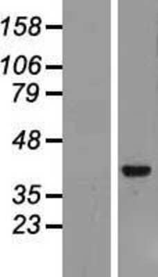 Western Blot: Archaemetzincin 2 Overexpression Lysate (Adult Normal) [NBP2-11211] Left-Empty vector transfected control cell lysate (HEK293 cell lysate); Right -Over-expression Lysate for Archaemetzincin 2.