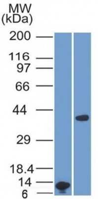 Western Blot: Arginase 1/ARG1/liver Arginase Antibody (ARG1/1125) - Azide and BSA Free [NBP2-47998] - Analysis A) Recombinant ARG1 Protein Fragment (B) human Liver Lysate using ARG1 Monoclonal Antibody (ARG1/1125).