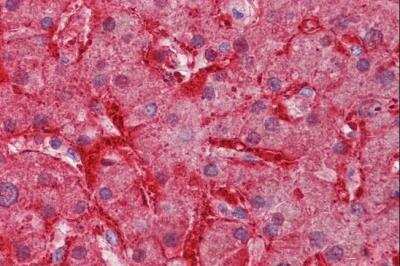 Immunohistochemistry-Paraffin: Arginase 1/ARG1/liver Arginase Antibody [NBP1-36936] - Staining of paraffin embedded Human Liver. Antibody at 3.75 ug/mL. Steamed antigen retrieval with citrate buffer pH 6, AP-staining.