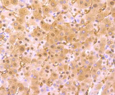 Immunohistochemistry-Paraffin: Arginase 1/ARG1/liver Arginase Antibody (JB21-49) [NBP2-75412] - Analysis of paraffin-embedded human liver tissue using anti-Liver Arginase antibody. Counter stained with hematoxylin.