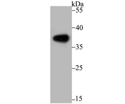 Western Blot: Arginase 1/ARG1/liver Arginase Antibody (JB21-49) [NBP2-75412] - Analysis of Liver Arginase on human liver tissue lysate using anti-Liver Arginase antibody at 1/500 dilution.