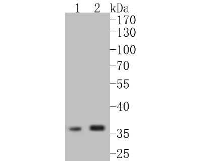 Western Blot: Arginase 1/ARG1/liver Arginase Antibody (SY09-06) [NBP2-67397] - Western blot analysis of Arginase 1/ARG1/liver Arginase on different lysates. Proteins were transferred to a PVDF membrane and blocked with 5% BSA in PBS for 1 hour at room temperature. The primary antibody (1/500) was used in 5% BSA at room temperature f