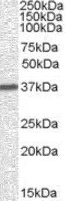 Western Blot: Arginase 1/ARG1/liver Arginase Antibody [NBP1-36936] - Staining of Human Liver lysate (35 ug protein in RIPA buffer). Antibody at 0.01 ug/mL. Detected by chemiluminescence.