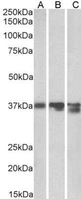 Western Blot: Arginase 1/ARG1/liver Arginase Antibody [NBP1-36936] - Analysis of Pig (A), Mouse (B) and Rat (C) Liver lysates (35 ug protein in RIPA buffer). Antibody at 0.03 ug/mL. Primary incubation was 1 hour. Detected by chemiluminescence.