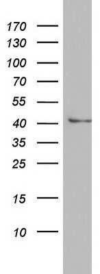 Western Blot: Argininosuccinate Lyase Antibody (OTI3D4) - Azide and BSA Free [NBP2-70213] - Analysis of HT29 cell lysate (35ug).