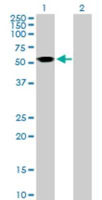 Western Blot: Argininosuccinate Lyase Antibody [H00000435-B01P] - Analysis of ASL expression in transfected 293T cell line by ASL polyclonal antibody.  Lane 1: ASL transfected lysate(51.04 KDa). Lane 2: Non-transfected lysate.