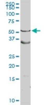 Western Blot: Argininosuccinate Lyase Antibody [H00000435-D01P] - Analysis of ASL expression in human liver.