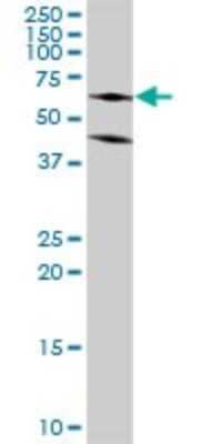 Western Blot: Argininosuccinate Lyase Antibody [H00000435-D01P] - Analysis of ASL expression in mouse kidney.