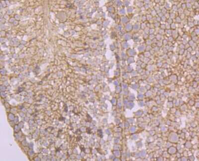 Immunohistochemistry-Paraffin: Argininosuccinate Synthase Antibody (11F1) [NBP2-76941] - Analysis of mouse testis tissue using anti-ASS1 antibody. Counter stained with hematoxylin.