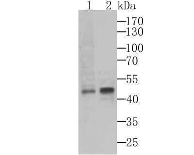 Western Blot: Argininosuccinate Synthase Antibody (11F1) [NBP2-76941] - Western blot analysis of ASS1 on HepG2 (1) and SiHa (2) cell lysate using anti-ASS1 antibody at 1/1,000 dilution.