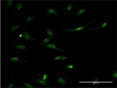 Immunocytochemistry/Immunofluorescence: Argininosuccinate Synthase Antibody (2D2) [H00000445-M02] - Analysis of monoclonal antibody to ASS1 on HeLa cell . Antibody concentration 10 ug/ml.