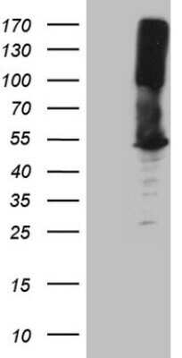 Western Blot: Argininosuccinate Synthase Antibody (OTI1B10) - Azide and BSA Free [NBP2-70217] - Analysis of HEK293T cells were transfected with the pCMV6-ENTRY control (Left lane) or pCMV6-ENTRY Argininosuccinate Synthase.