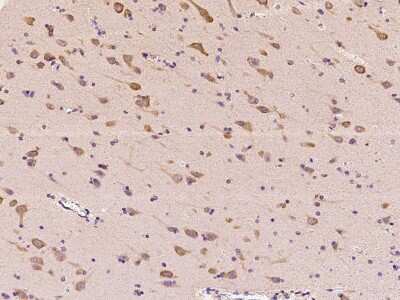 Immunohistochemistry-Paraffin: Arginyl tRNA synthetase Antibody [NBP2-97635] - Immunochemical staining of human Arginyl tRNA synthetase in human brain with rabbit polyclonal antibody at 1:100 dilution, formalin-fixed paraffin embedded sections.